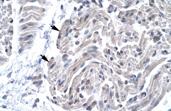 FOXE3 Antibody