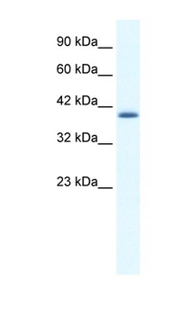 ZNF365 Antibody