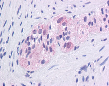 EGR1 Antibody