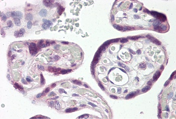 DLX3 Antibody