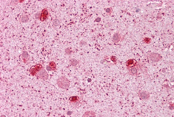 GSH2 Antibody