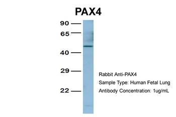 PAX4 Antibody