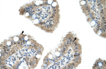 NAB1 Antibody