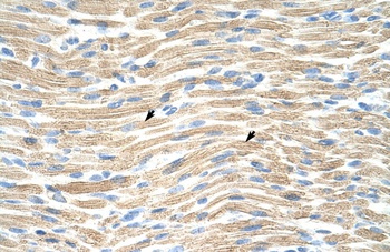 LMX1A Antibody