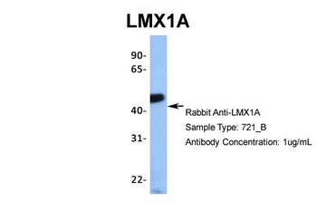 LMX1A Antibody