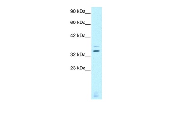 VSX2 Antibody