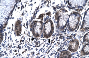 HCLS1 Antibody