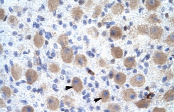 OR13C9 Antibody