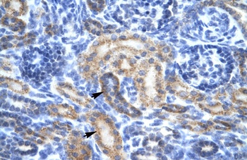 OR13C9 Antibody