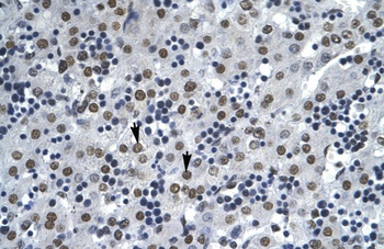 AATF Antibody