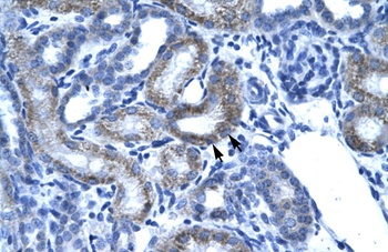 SSBP2 Antibody