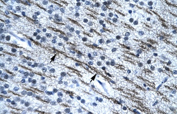 SSBP2 Antibody