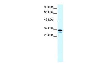 SSBP2 Antibody