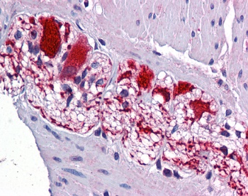 SSBP2 Antibody