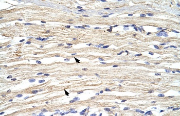 KDM2A Antibody