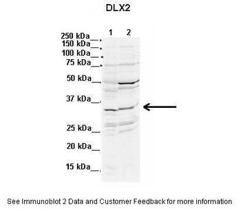 DLX2 Antibody
