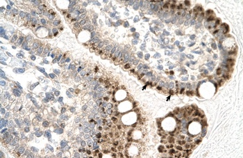 ZFP1 Antibody