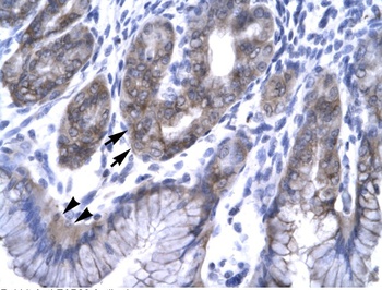 SNF8 Antibody