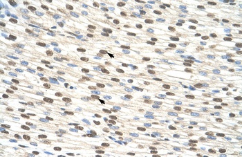 ZNF274 Antibody