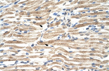 YAF2 Antibody