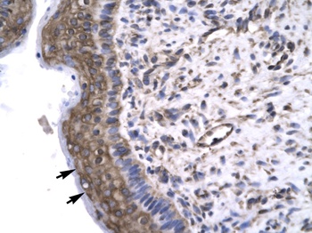 GTF2F2 Antibody