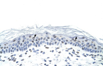 FOSL1 Antibody