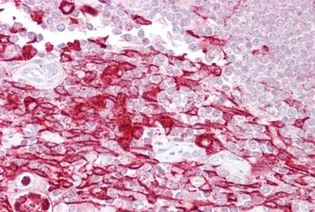 ATF1 Antibody