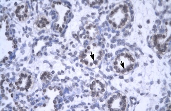 YEATS4 Antibody
