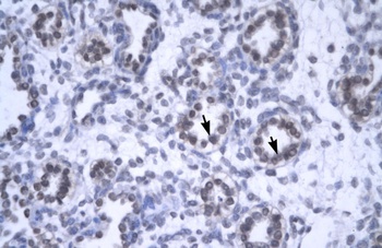 YEATS4 Antibody