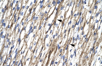 RBM10 Antibody