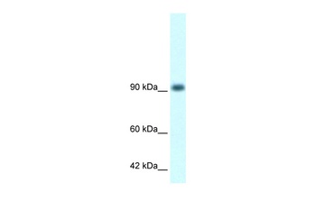 RBM10 Antibody