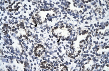 RBM10 Antibody