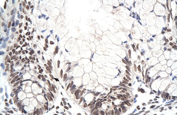 ZNF394 Antibody