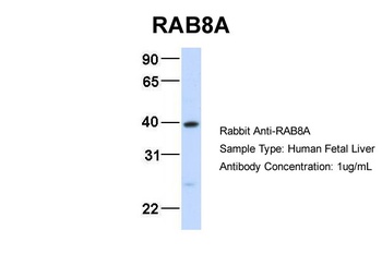 RAB8A Antibody