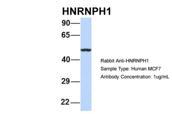 HNRNPH1 Antibody