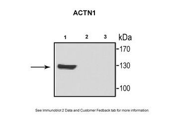 ACTN1 Antibody