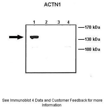 ACTN1 Antibody