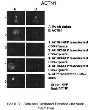 ACTN1 Antibody