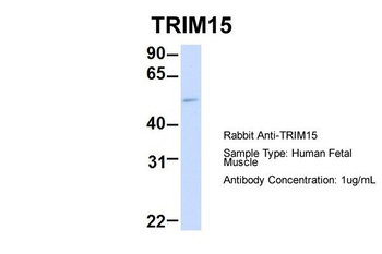 TRIM15 Antibody