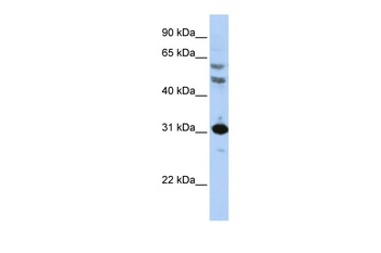 HOXB5 Antibody