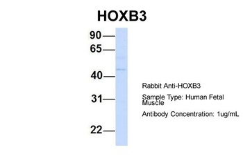HOXB3 Antibody