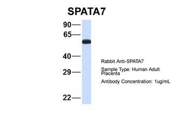 SPATA7 Antibody