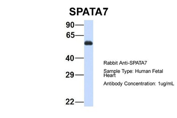 SPATA7 Antibody