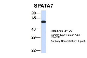 SPATA7 Antibody