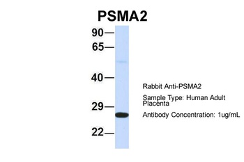 PSMA2 Antibody