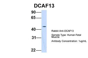 WDSOF1 Antibody