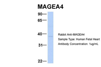 MAGEA4 Antibody