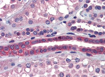 SSX2IP Antibody