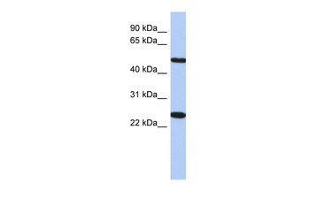 TMEM161B Antibody