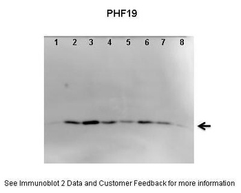 PHF19 Antibody
